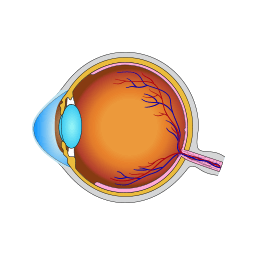 keratoconus