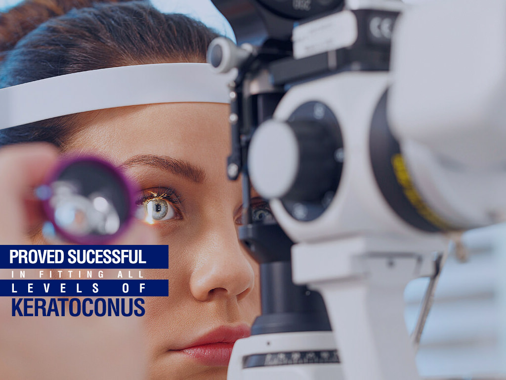 keratoconus